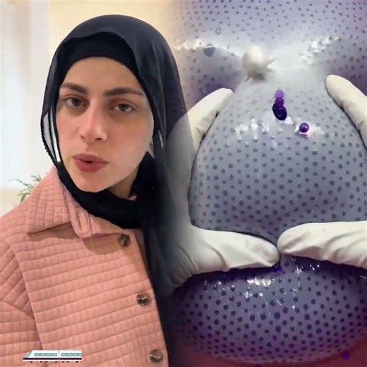 تبصش في حياة غيرك…👀😭❤️‍🩹فديو تمثيلي لنشر الخير بين الناس كريم حسنين