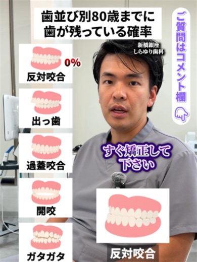 歯並び別の80歳までに歯が残る確率｜反対咬合・出っ歯・開咬の違い