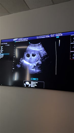 Don’t mind me just tweaking out #twinpregnancy 😐😐😐 | Pregnant