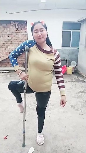 Polio with twisted crippled leg.