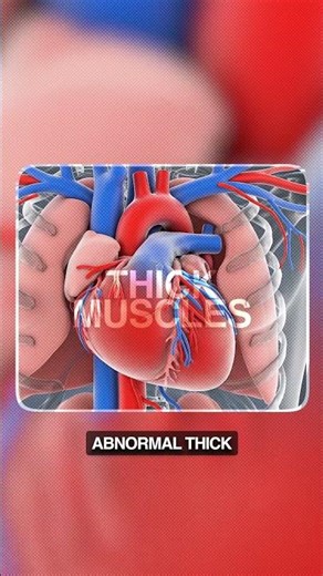 Why Fit Young People Are Collapsing: The Truth About HCM & Heart Health 📉💔