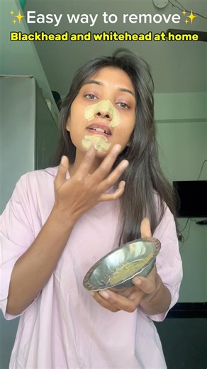Easy way to remove Blackhead whitehead at home🤫#skincare #hack #ytshorts #telugushorts