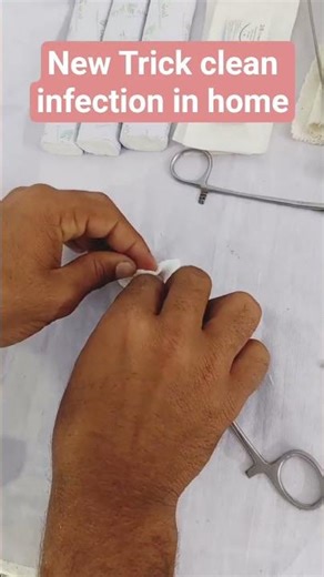 Wound Infection Cleaning at Home |