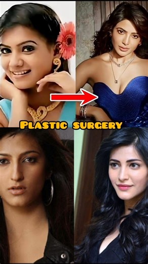 PLASTIC SURGERY செய்து அழகா மாறிய மூன்று நடிகைகள் 😱#shortfeed #short#tamilactor#plasticsurgery