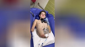 Man Who Lost Half of His Body in a Forklift Crash at a Construction Site Goes Viral