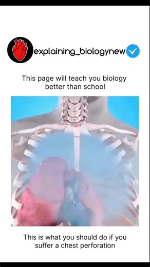 MEDICAL | BIOLOGY| STUDENT on Instagram: "WOULD YOU KNOW WHAT TO DO? 🧠 A chest perforation isn't just a wound; it's a race against physics. When the chest wall is breached, the pressure that keeps your lungs inflated vanishes, leading to a collapsed lung (pneumothorax). This 3D breakdown shows why you should NEVER pull out the object and how a vented chest seal can literally save a life by allowing air out but not in.blood Biology isn't just a school subject-it's the manual for your own surviva