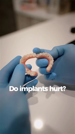 𝐓𝐞𝐱𝐚𝐬 𝐈𝐦𝐩𝐥𝐚𝐧𝐭 & 𝐃𝐞𝐧𝐭𝐚𝐥 𝐒𝐩𝐞𝐜𝐢𝐚𝐥𝐢𝐬𝐭𝐬 - 𝐃𝐫. 𝐌𝐚𝐫𝐜𝐨 𝐂𝐮𝐞𝐯𝐚 𝐃𝐃𝐒, 𝐌𝐒 on Instagram: "Stop waiting because you are afraid of pain. The reality of modern dental implants is very different from what you imagine. Local anesthesia + Sedation. Minimally invasive 3D planning. Mild, manageable recovery. It’s science, not mystery. Let’s restore your smile comfortably. #implants #allon4"