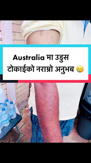 Identifying and Treating Bed Bug Infestations