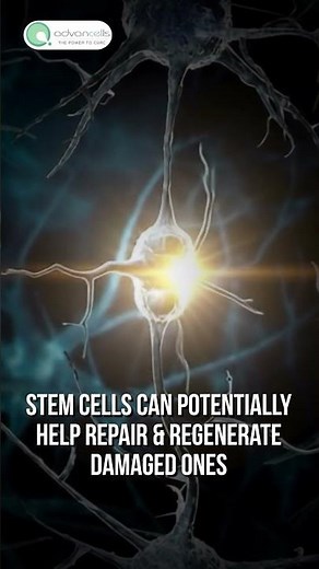 Top Neuroscientist Reveals 5 Ways Stem Cells Can REGENERATE Your Brain