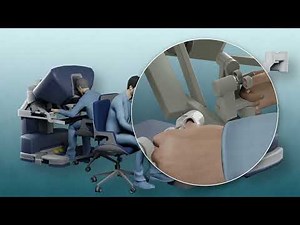 Robot-Assisted Radical Prostatectomy Explained | Prostate Cancer Surgery at Urocat