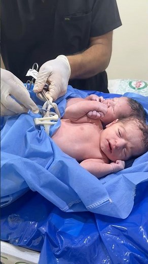 The twin brothers hold hands during difficult times. #newbornarrival