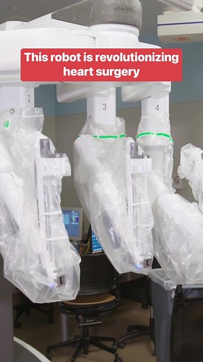 This robot helps doctors perform minimally invasive surgeries. #surgery #robots #doctors