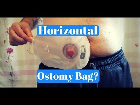 Wearing Your Ostomy Bag Horizontally: FAQ