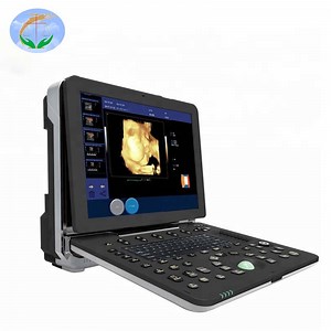 [Hot Item] Pregnancy Diagnostic Laptop 4D Color Ultrasound Scanner