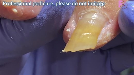 Extra Long Toenails: Silky Smooth Pedicure Tutorial