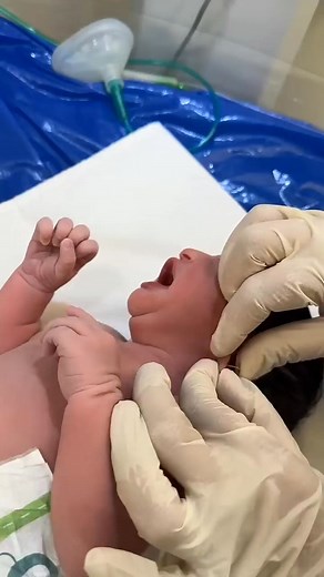 #baby #newborn #doctor #cute #viral #doublebaby #littlechild #child #girlbaby #children | ONE DAY BABY