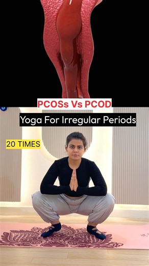 PCOS/PCOD Workout | 20 Min Fat Loss & Hormone Balance Routine 🔥