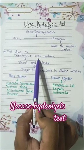 urease hydrolysis test biochemical identification microbiology #youtubeshorts #youtobe Vira