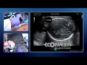 EcoimagenTips: ¿𝗖𝗼𝗺𝗼 𝗿𝗲𝗮𝗹𝗶𝘇𝗮𝗿 𝗹𝗮 𝗕𝗜𝗢𝗠𝗘𝗧𝗥𝗜́𝗔 𝗙𝗘𝗧𝗔𝗟?