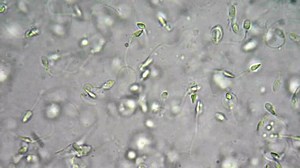 Live Human Sperm Spermatozoa Motion Under Stock Footage Video (100% Royalty-free) 4431764 | Shutterstock