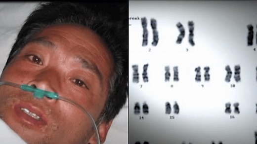 Reason why 'radioactive man' who suffered one of the most painful deaths ever was kept alive for 83 days