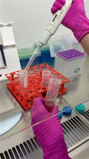 PBMC Isolation (Ficoll-Paque)