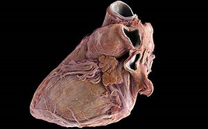 ‘Google Earth for the human heart’ set to accelerate cardiovascular medicine