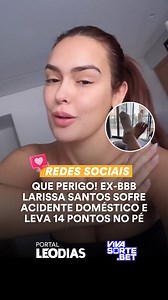90K views · 814 reactions | Larissa Santos, ex-participante do Big Brother Brasil 23, passou por um grande susto. A influenciadora precisou levar 14 pontos no pé depois que o box do banheiro estourou de forma inesperada, provocando cortes profundos. O acidente aconteceu no fim de semana, mas foi só na segunda-feira (05/05) que ela conseguiu falar sobre o assunto com os seguidores. SAIBA MAIS CLICANDO NO LINK DA BIO!  Leia a matéria completa no portalleodias.com | Leo Dias | Facebook