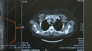 MRI scan screen animation. Computed medical tomography MRI. Diagnosis medical data