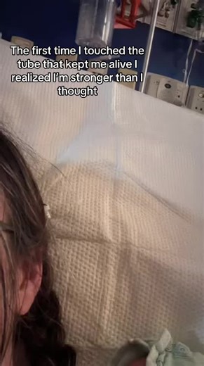 External Ventricular Drain: Life-Saving Brain Pressure Relief