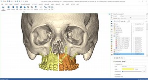 3.9K views · 271 reactions | Achieve scalable and efficient personalized care with the latest updates to Mimics Innovation Suite. See what's new here. | Materialise | Facebook