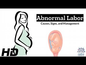Abnormal Labor: Navigating the Unexpected on the Journey to Birth