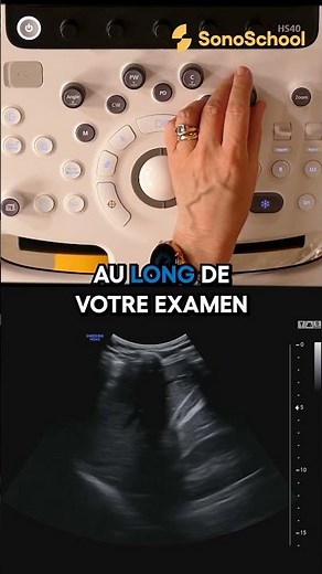 Échographie abdominale : rappels d’installation et réglages - iSonic | SonoSchool