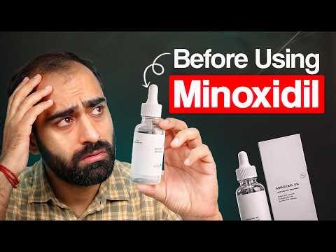 Uses and Side Effects of Minoxidil (HX-EGOM) | Minoxidil For Hair Growth | How does Minoxidil work