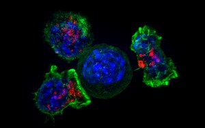 Rare Immune Cells Prevent Cancer from Spreading | Immunology