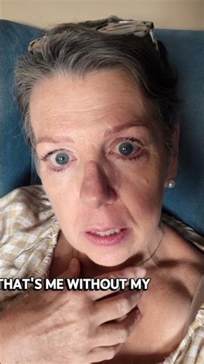 The Truth About Microblading Healing – Day 2