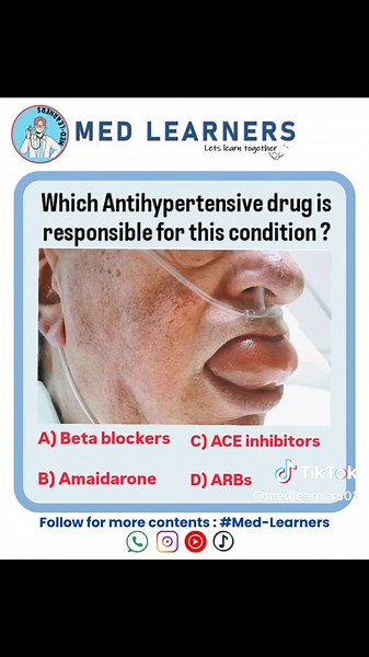 Pharmacology Quiz on Hypertension for Medical Students