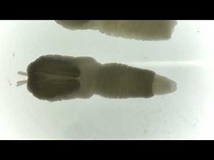 【寄生虫】魚から検出したニベリニア（ニベリン条虫）