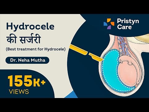 हाइड्रोसील की सर्जरी | Treatments For Hydrocele - For FREE Consultation Call On 08065417736