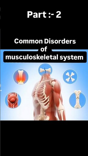 disorders of Musculoskeletal system | Adult health nursing