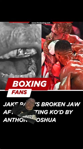 FTTV Boxing on Instagram: "YOU DON’T PLAY BOXING. 📉🥊 Jake Paul finds out there are levels to this with a broken jaw after a brutal Rd 6 KO by 2x Champ Anthony Joshua. You can't play against the elite. 🦴💥 Is this the reality check influencer boxing needed? Fury next? 👇 #Boxing #JakePaul #PaulJoshua #Netflix #Sports #anthonyjoshua #elitefighters #knockout"