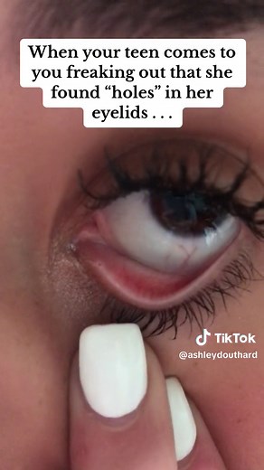 Understanding Tear Ducts and Tear Stains | Mom's Anatomy Lesson