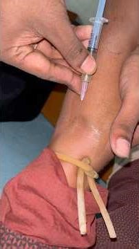 Iv injection procedure #ivinjection #doctors #hindu #hospital #sortfeed #sortvideo