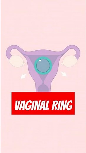 Vaginal Ring Birth Control Explained: How It Works, Effectiveness, & Side Effects #shorts
