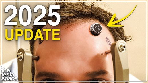 Everything About Neuralink You Need to Know