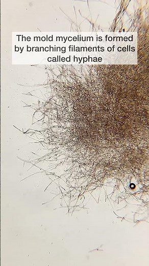 This is what mold looks like under the microscope