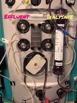 CRRT High Dose - When and How? - Prismaflex 8.1