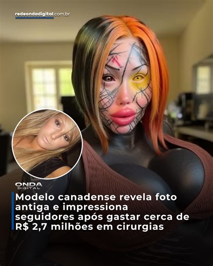 Rede Onda Digital on Instagram: "A modelo canadense Mary Magdalene surpreendeu seguidores ao divulgar uma foto de sua aparência antes de qualquer cirurgia plástica. Hoje, aos 30 anos, ela já gastou cerca de R$ 2,7 milhões em procedimentos para alcançar o visual que define como uma “deusa híbrida e apocalíptica”. Além das cirurgias extremas, Mary possui o corpo coberto por tatuagens, incluindo uma grande área totalmente preta, e até pigmentou os olhos de verde neon. A imagem antiga, em que aparec