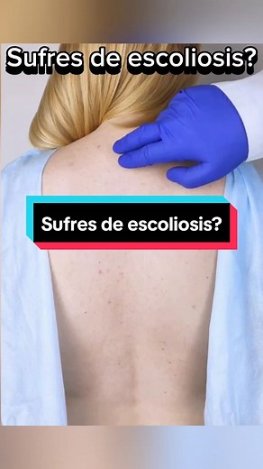 Ejercicios Efectivos para Escoliosis y Dolor de Espalda