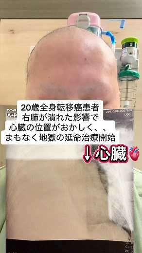 闘魂一心！新たな延命治療への挑戦